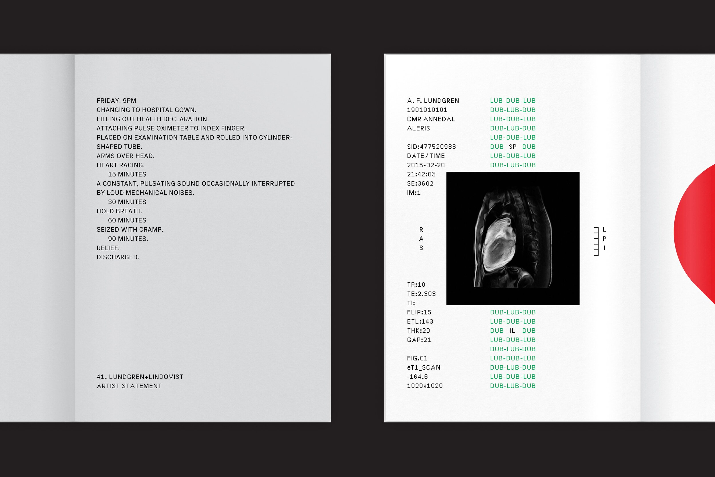 Lundgren+Lindqvist - The Heart Index