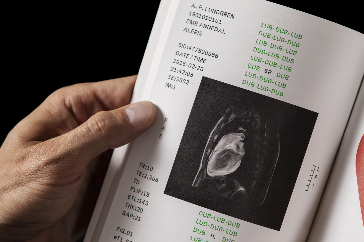 Lundgren+Lindqvist - The Heart Index